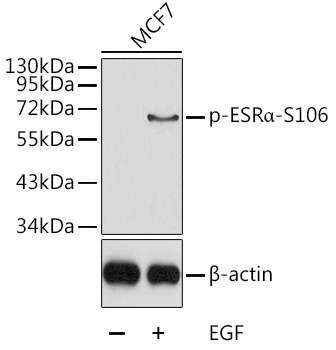 Phospho-ESRAlpha-S106 Rabbit Polyclonal Antibody