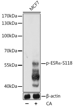 Phospho-ESRAlpha-S118 Rabbit Polyclonal Antibody