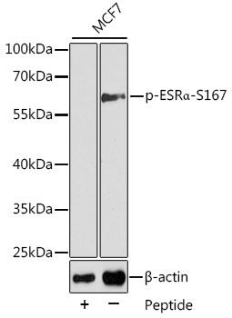 Phospho-ESRAlpha-S167 Rabbit Polyclonal Antibody