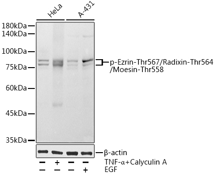 Phospho-Ezrin-Thr567/Radixin-Thr564/Moesin-Thr558 Rabbit Polyclonal Antibody