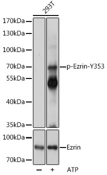 Phospho-Ezrin-Y353 Rabbit Polyclonal Antibody