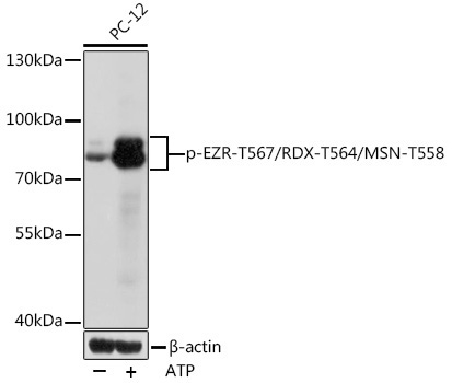 Phospho-EZR-T567/RDX-T564/MSN-T558 Rabbit Polyclonal Antibody