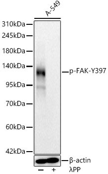 Phospho-FAK-Y397 Rabbit Monoclonal Antibody