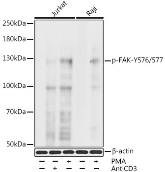 Phospho-FAK-Y576/577 Rabbit Polyclonal Antibody