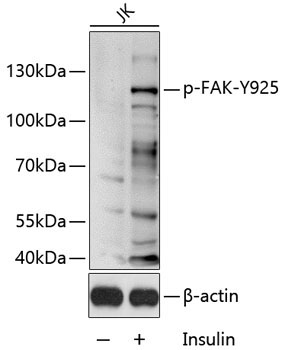 Phospho-FAK-Y925 Rabbit Polyclonal Antibody