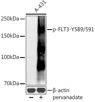 Phospho-FLT3-Y589/591 Rabbit Polyclonal Antibody