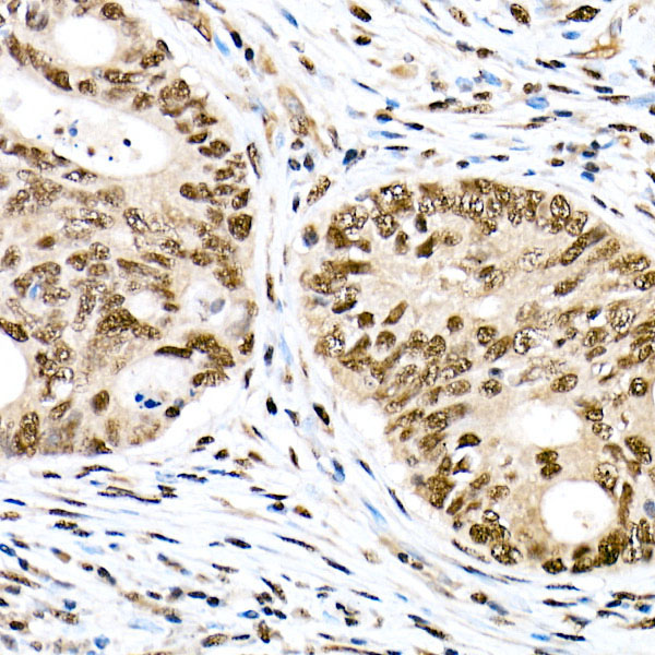 Phospho-FOXO1-S319 Rabbit Polyclonal Antibody - Image 2