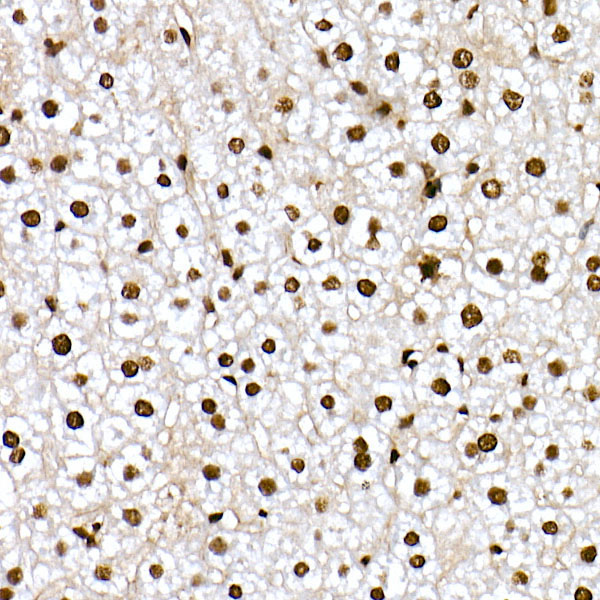 Phospho-FOXO1-S319 Rabbit Polyclonal Antibody - Image 3