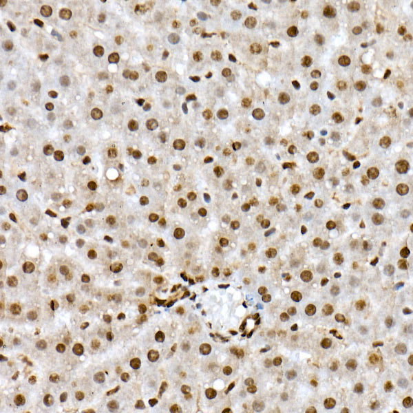 Phospho-FOXO1-S319 Rabbit Polyclonal Antibody - Image 4