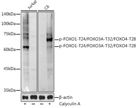 Phospho-FOXO1-T24/FOXO3A-T32/FOXO4-T28 Rabbit Polyclonal Antibody