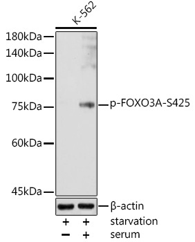 Phospho-FOXO3A-S425 Rabbit Polyclonal Antibody