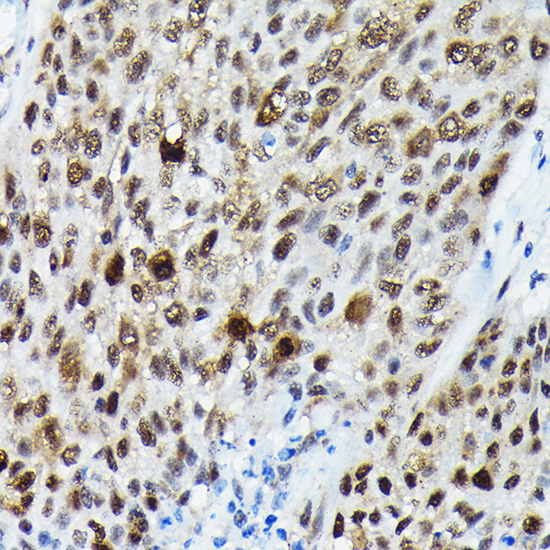 Phospho-FOXO3A-S425 Rabbit Polyclonal Antibody - Image 3