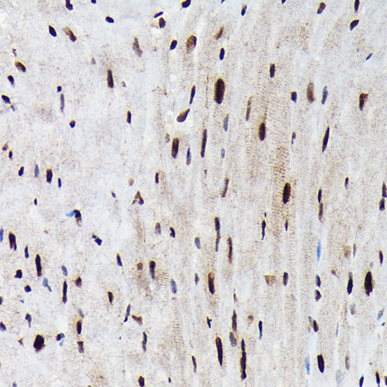 Phospho-FOXO3A-S425 Rabbit Polyclonal Antibody - Image 4
