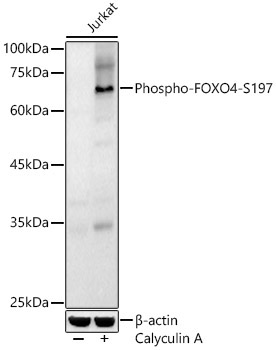 Phospho-FOXO4-S197 Rabbit Polyclonal Antibody - Image 2