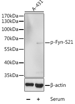 Phospho-Fyn-S21 Rabbit Polyclonal Antibody