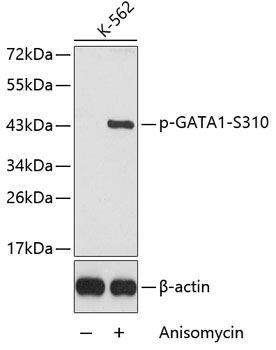 Phospho-GATA1-S310 Rabbit Polyclonal Antibody