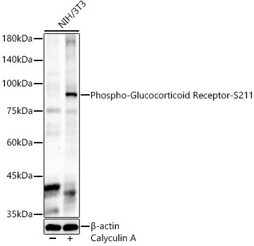 Phospho-Glucocorticoid Receptor-S211 Rabbit Polyclonal Antibody