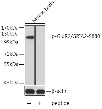 Phospho-GluR2/GRIA2-S880 Rabbit Polyclonal Antibody