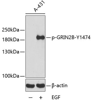 Phospho-GRIN2B-Y1474 Rabbit Polyclonal Antibody
