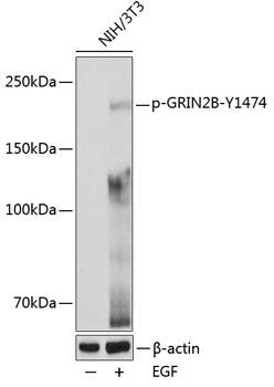 Phospho-GRIN2B-Y1474 Rabbit Polyclonal Antibody