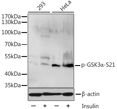 Phospho-GSK3Alpha-S21 Rabbit Polyclonal Antibody