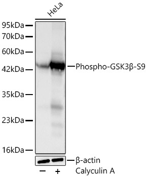 Phospho-GSK3Beta-S9 Rabbit Monoclonal Antibody
