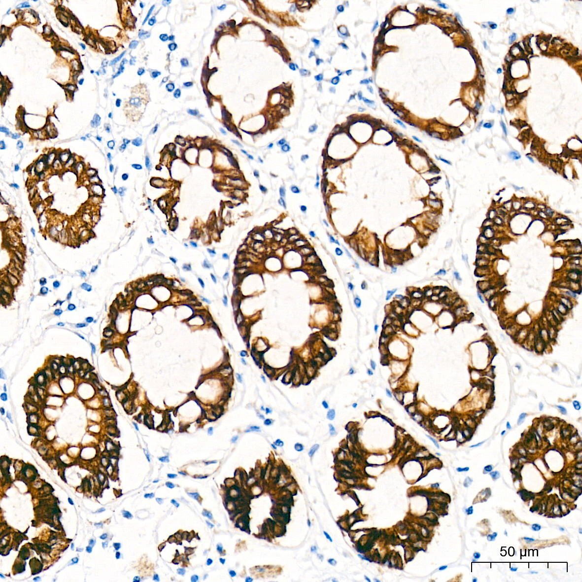Phospho-GSK3Beta-S9 Rabbit Monoclonal Antibody - Image 3