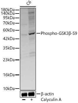 Phospho-GSK3Beta-S9 Rabbit Polyclonal Antibody