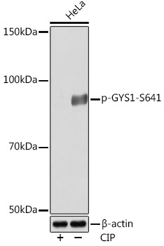 Phospho-GYS1-S641 Rabbit Monoclonal Antibody