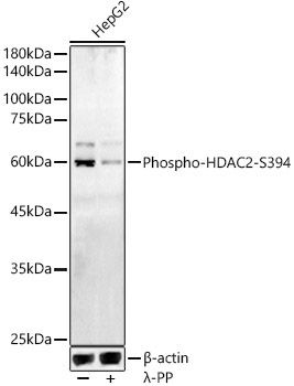 Phospho-HDAC2-S394 Rabbit Polyclonal Antibody
