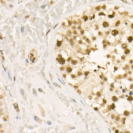 Phospho-HDAC2-S394 Rabbit Polyclonal Antibody - Image 2