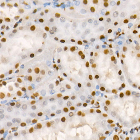 Phospho-HDAC2-S394 Rabbit Polyclonal Antibody - Image 3