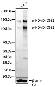 Phospho-HDAC4-S632 Rabbit Monoclonal Antibody