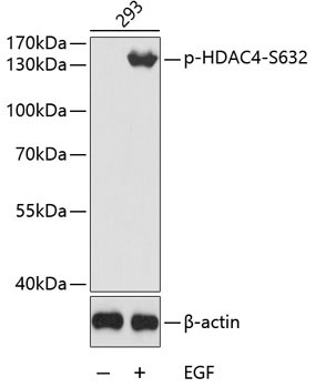 Phospho-HDAC4-S632 Rabbit Polyclonal Antibody