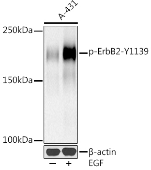 Phospho-HER2/ErbB2-Y1139 Rabbit Monoclonal Antibody