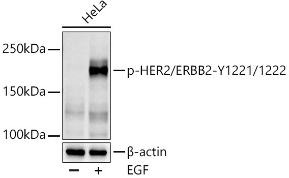 Phospho-HER2/ErbB2-Y1221/1222 Rabbit Polyclonal Antibody
