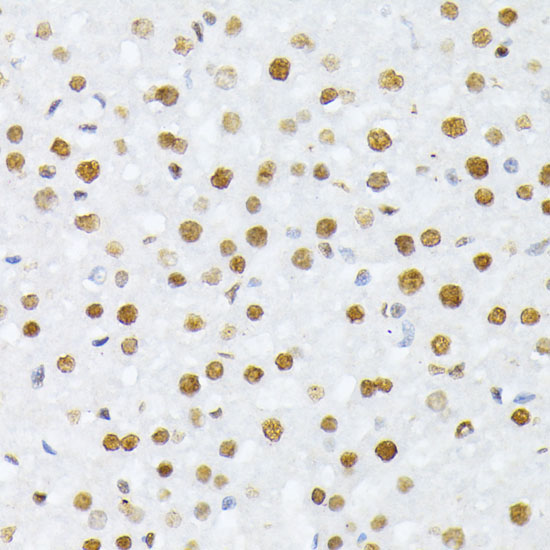 Phospho-Histone H2A-S129 Rabbit Polyclonal Antibody