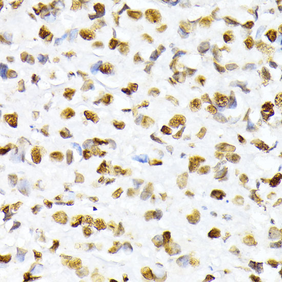 Phospho-Histone H2A-S129 Rabbit Polyclonal Antibody - Image 2