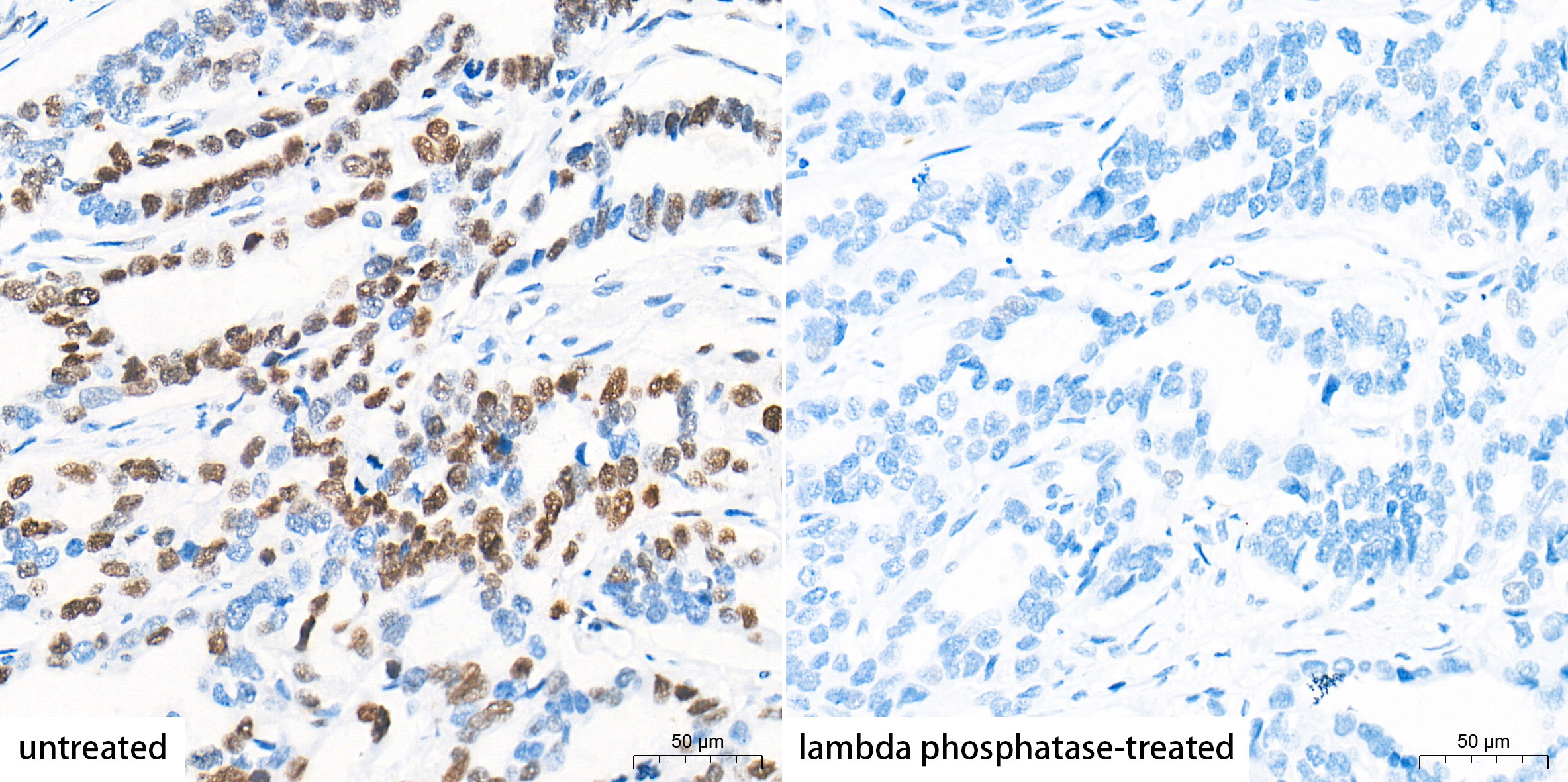 Phospho-Histone H2AX-S139 Rabbit Monoclonal Antibody - Image 3