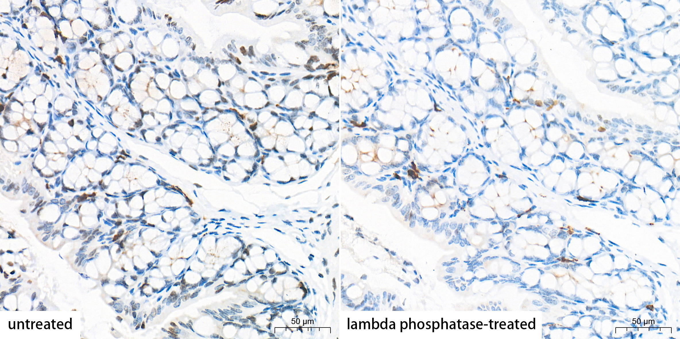 Phospho-Histone H2AX-S139 Rabbit Monoclonal Antibody - Image 4