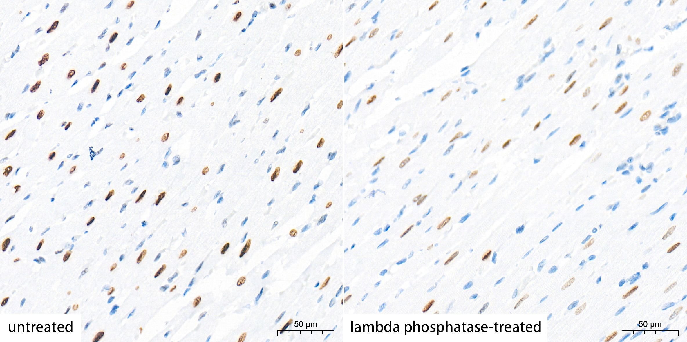 Phospho-Histone H2AX-S139 Rabbit Monoclonal Antibody - Image 5