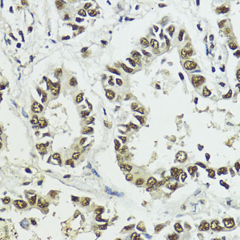 Phospho-Histone H3-S10/T11 Rabbit Polyclonal Antibody - Image 3
