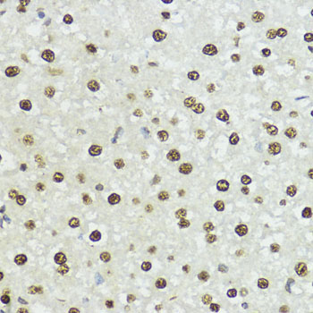 Phospho-Histone H3-S10/T11 Rabbit Polyclonal Antibody - Image 4