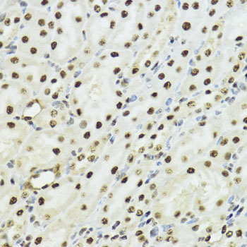Phospho-Histone H3-S10/T11 Rabbit Polyclonal Antibody - Image 5