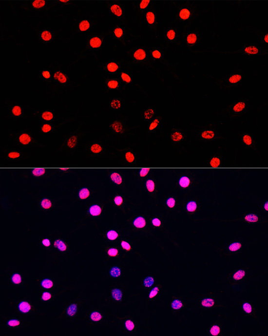 Phospho-Histone H3-S10/T11 Rabbit Polyclonal Antibody - Image 6