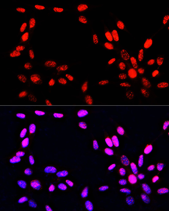 Phospho-Histone H3-S10/T11 Rabbit Polyclonal Antibody - Image 7