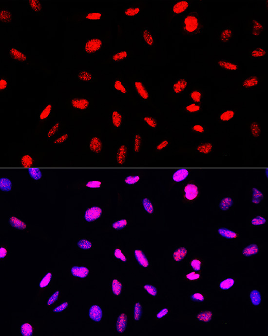 Phospho-Histone H3-S10/T11 Rabbit Polyclonal Antibody - Image 8