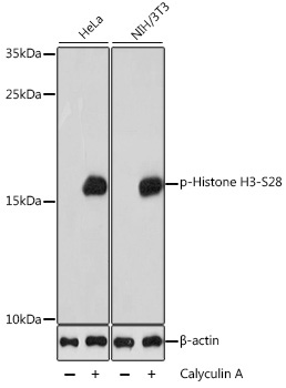 Phospho-Histone H3-S28 Rabbit Polyclonal Antibody