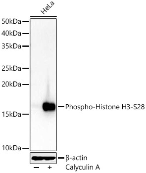 Phospho-Histone H3-S28 Rabbit Polyclonal Antibody - Image 2