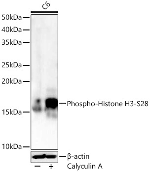 Phospho-Histone H3-S28 Rabbit Polyclonal Antibody - Image 3